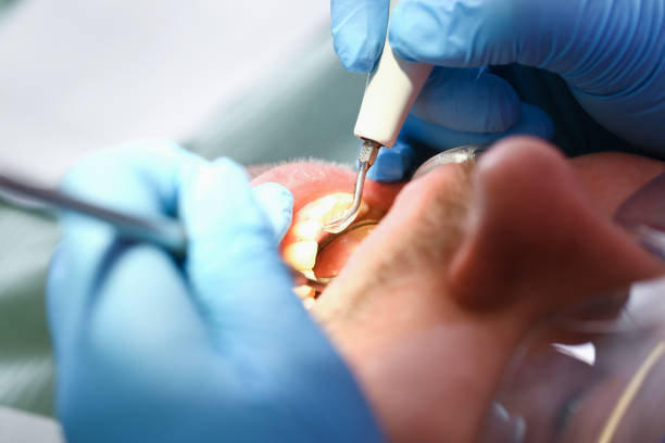 Best Emergency Treatment for Oral Infections in Worcester, MA