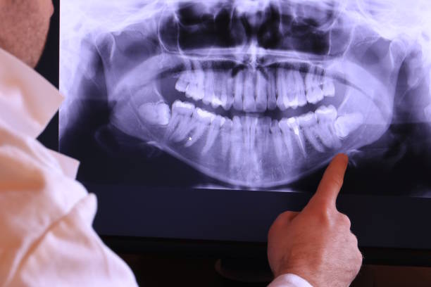 Best Emergency X-Rays and Diagnostics in Worcester, MA